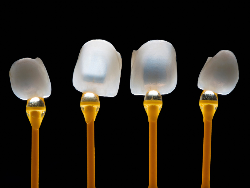 Dental Veneer Dallas TX