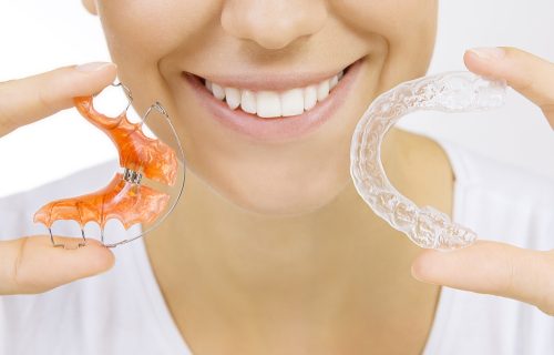 Can Wearing Retainers Fix Your Teeth?