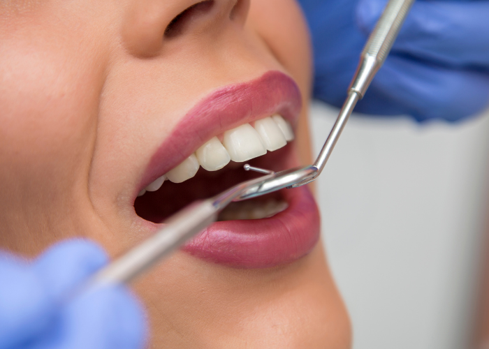 Say Goodbye to Sensitive Teeth