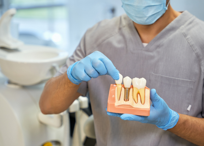 Future of Dental Implants