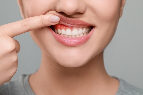 Why Your Dentist Measures Your Gums