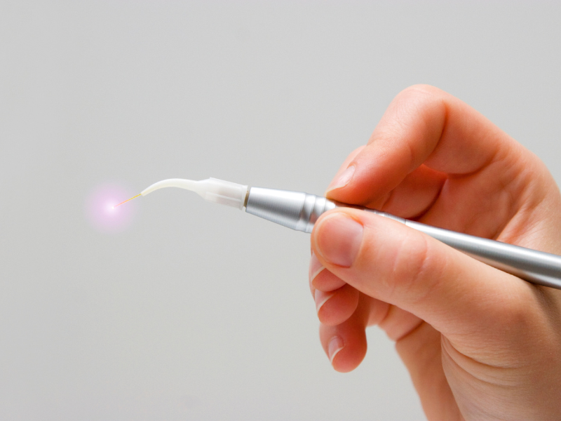 Laser Dentistry in Dallas, TX